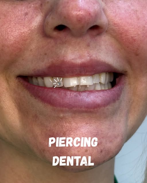 Piercing dental aplicado