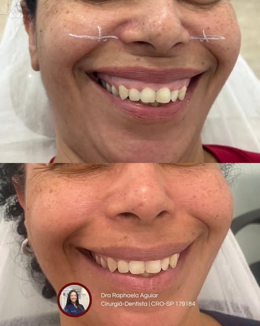 Transformação do sorriso
