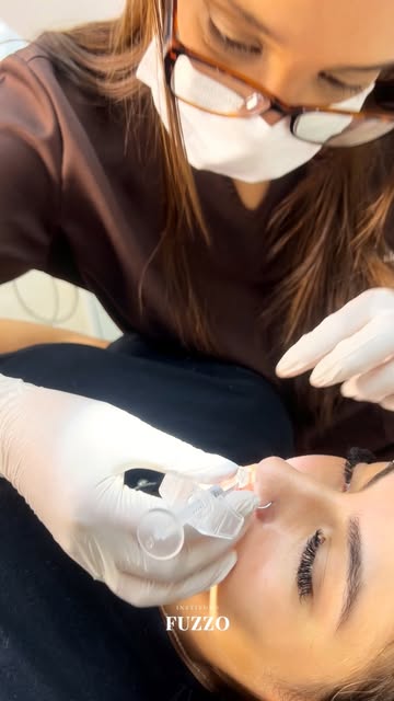 Paciente em sessão de clareamento dental no Instituto Fuzzo